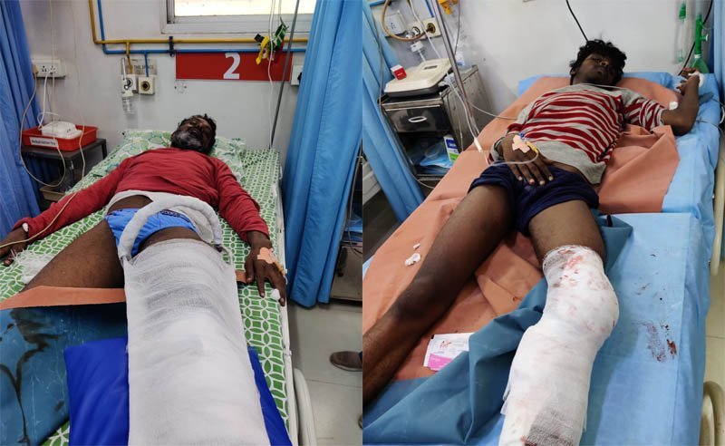 BBMP ex-corporator’s murder: 2 suspects attack cops, shot in the leg 1 Rekha Kadiresh Murder accused injured in police firing