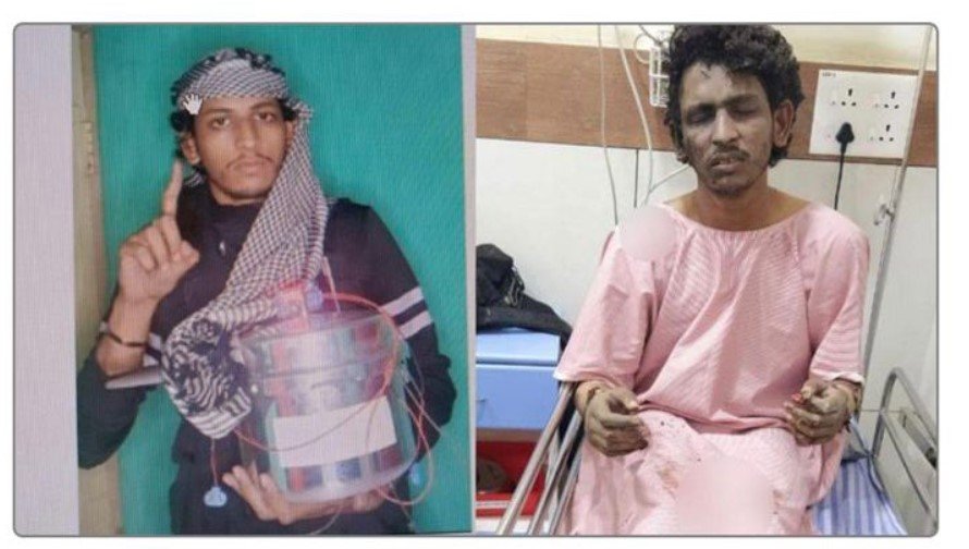 Mangaluru blast accused shared terror videos with co-accused 1 Mangaluru Blast Cooker Bomb suspect