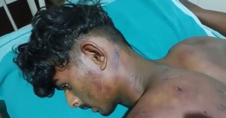 Student attacked for talking to girl in coastal Karnataka, admitted in hospital 1 Student attacked for talking to girl in coastal Karnataka, admitted in hospital