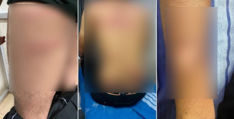 Muslim youth arrested for alleged moral policing in Mangaluru 7 Muslim youth arrested for alleged moral policing in Mangaluru