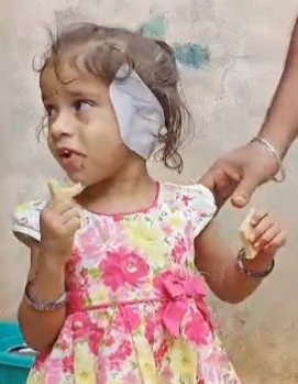 4-year-old child miraculously escaped in stray dog attack