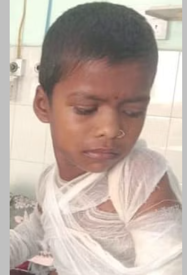 Kalaburagi | Tragedy Strikes as Student Succumbs to Injuries from Sambar Mishap