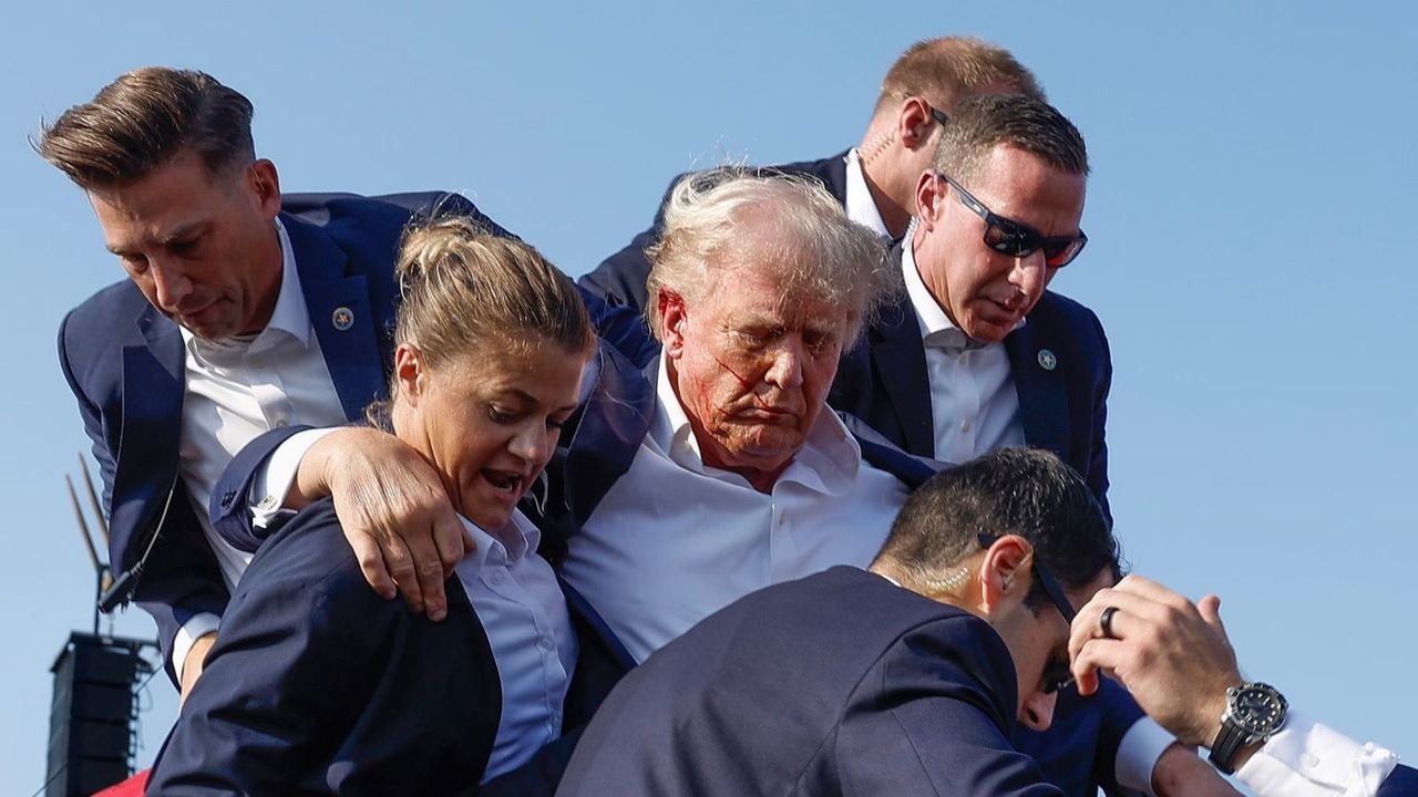 Trump underwent precautionary CT scan after assassination attempt: Report 1 Trump underwent precautionary CT scan after assassination attempt: Report